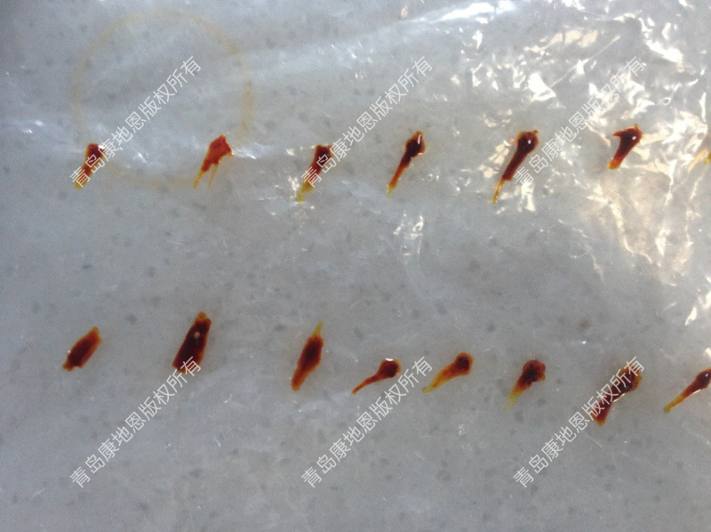 碘凝集檢測結果圖-青島康地恩