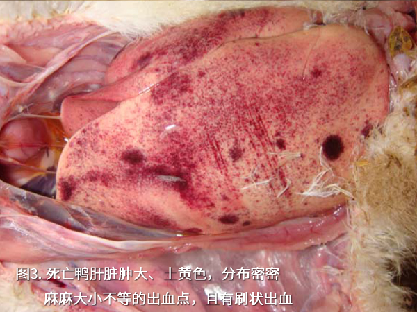 死亡鴨肝臟腫大、土黃色，分布密密麻麻大小不等的出血點(diǎn)，且有刷狀出血